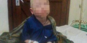 Djalit 6 vjeçar ia prenë dorën sepse ka lëkurë të pasur