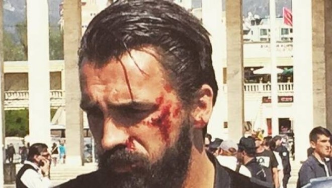 Kush e “rrahu” Blerim Destanin (Foto)