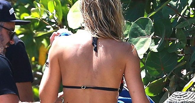 Lauren Stoner ka një byçë për ta pasur zili (Foto)