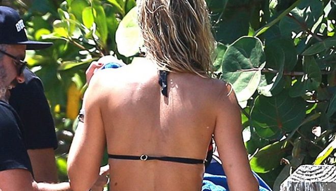 Lauren Stoner ka një byçë për ta pasur zili (Foto)