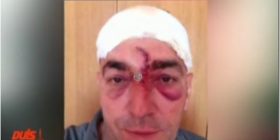 Vitaku: U kam paguar haraç personave që janë thirrur në emër të komandant Remit e Latës (Foto/Video)