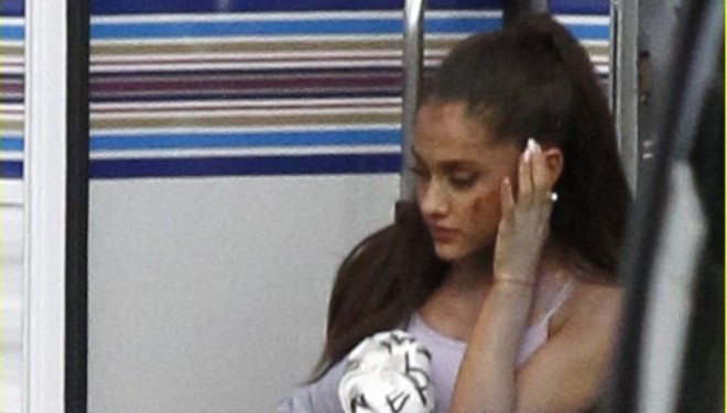 Ariana Grande gjakoset në fytyrë