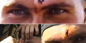 Me plumb në ballë, shpëtoi i gjallë dhe buzëqeshi për kamerën (Video)