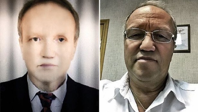 Shndërrohet në zezak pas transplantimit të mëlçisë nga donatori afrikano-amerikan (Foto)