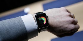 Apple Watch shkakton djegie lëkure