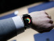 Apple Watch shkakton djegie lëkure