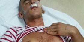 “Komitët” sulmojnë disa shqiptarë nga Batinca e Shkupit (Foto/Video)