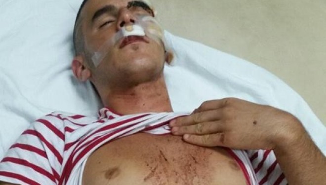 “Komitët” sulmojnë disa shqiptarë nga Batinca e Shkupit (Foto/Video)