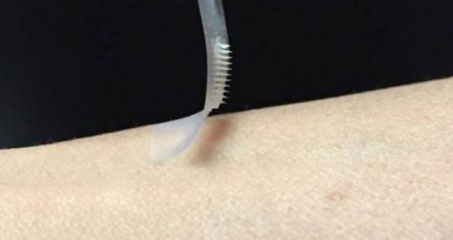 Lajm i mirë për diabetikët: Insulina tash mundet me u marr me elastoplas / fllaster