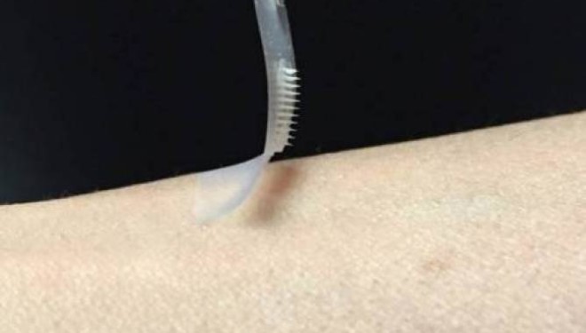 Lajm i mirë për diabetikët: Insulina tash mundet me u marr me elastoplas / fllaster