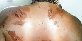 E mitura rrahet nga familja pasi refuzoi të martohej me 78 vjeçarin