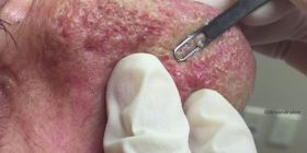 Ajo që bën kjo dermatologe do ua shpifë