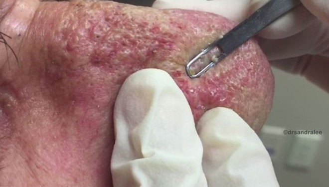 Ajo që bën kjo dermatologe do ua shpifë
