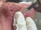 Ajo që bën kjo dermatologe do ua shpifë