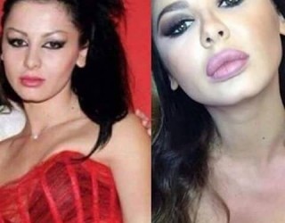 Ja si e kanë transformuar operacionet Aurelën (Foto)