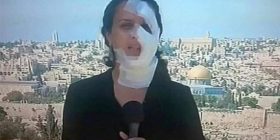Gazetarja kthehet e fashuar në ekran pasi u godit në fytyrë nga një granatë (Foto/Video)