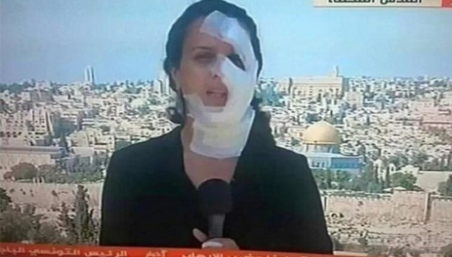 Gazetarja kthehet e fashuar në ekran pasi u godit në fytyrë nga një granatë (Foto/Video)