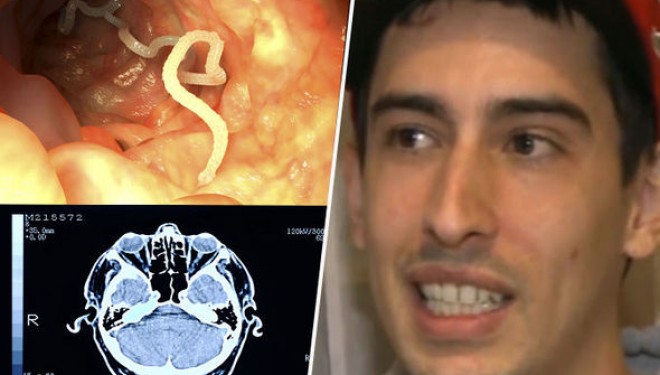 I thonë se i ka vetëm 30 minuta jetë, por kur doktorët zbulojnë çfarë ka në trurin e tij … (VIDEO)