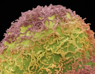 Terapia “vetëvrasëse” ndaj kancerit të prostatës