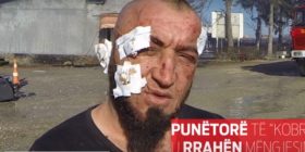 ‘Kobrat’ rrëfehen pas zjarrit (Video)