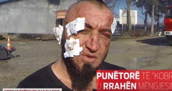 ‘Kobrat’ rrëfehen pas zjarrit (Video)