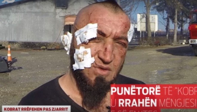 ‘Kobrat’ rrëfehen pas zjarrit (Video)