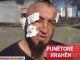 ‘Kobrat’ rrëfehen pas zjarrit (Video)