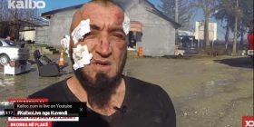 ‘Kobrat’ Rrëfehen pas Zjarrit (Video)