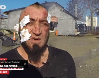 ‘Kobrat’ Rrëfehen pas Zjarrit (Video)