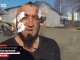 ‘Kobrat’ Rrëfehen pas Zjarrit (Video)