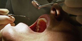Dentisti i jep anestezion pacientit dhe ja fut penisin në gojë (FOTO)