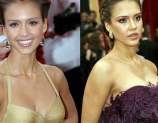 Kanë bërë apo jo operacion në gjoks këto VIP-a? (FOTO)