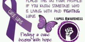 Në Kosovë kurrë nuk flitet për sëmundjen e lëkurës Lupus