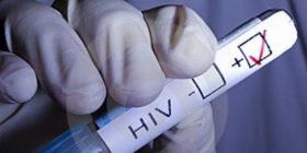 Të prekurit me HIV AIDS tashmë do t’i dalloni nga tatuazhi (Foto)