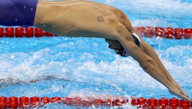 Ja përse atletët në “Rio 2016” kanë pulla të kuqe në shpinë