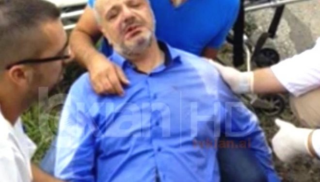 Shqipëria e rrezikshme: Vjen për të investuar, e bëjnë për spital