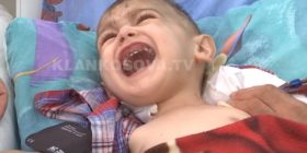 Tre vjeçari nga Podujeva në nevojë për transplant të veshkave (Video)