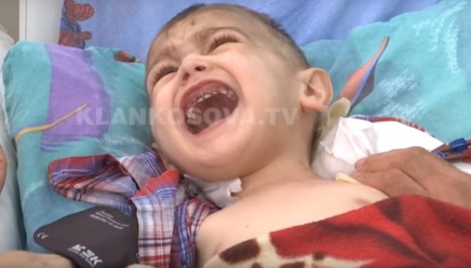 Tre vjeçari nga Podujeva në nevojë për transplant të veshkave (Video)