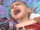 Tre vjeçari nga Podujeva në nevojë për transplant të veshkave (Video)