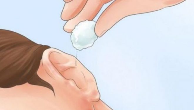 Metoda më e lehtë dhe më e sigurt për heqjen e dyllit në vesh