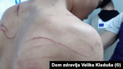 Një tjetër migrant i lënduar në Vellika Klladusha.