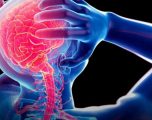 Llojet e dhimbjeve të kokës – Kur duhet të shqetësoheni?