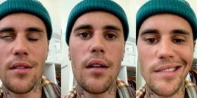 Justin Bieber anulon koncertet për shkak të paralizës në fytyrë