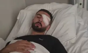 “Plumbin e kam ende në sy”, rrëfehet 28-vjeçari që u plagos në protestë: Isha 30 metra larg efektivëve, po rrija pa asnjë reagim