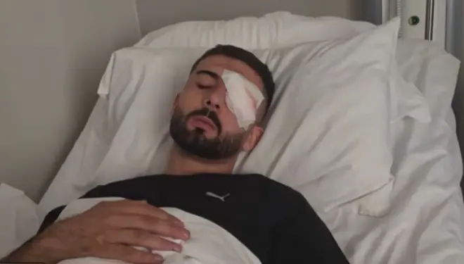 “Plumbin e kam ende në sy”, rrëfehet 28-vjeçari që u plagos në protestë: Isha 30 metra larg efektivëve, po rrija pa asnjë reagim